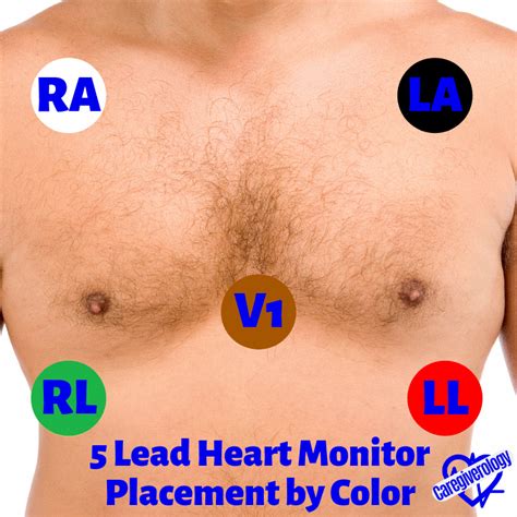 lead placement for cardiac monitoring.